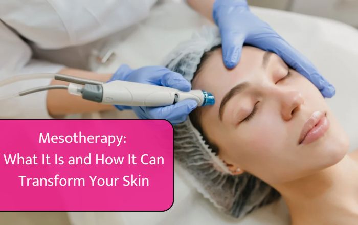 Mesotherapy: What It Is and How It Can Transform Your Skin