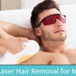 Laser Hair Removal for Men: Complete Guide