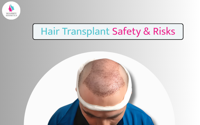 Is Hair Transplant Safe? Risks and Side Effects Explained