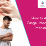 How to Avoid Fungal Infections in Monsoon