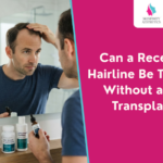 Can a Receding Hairline Be Treated Without a Hair Transplant?